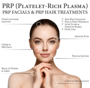 Platelet-rich plasma therapy bali