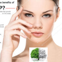 benefits of Platelet-rich plasma