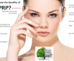 benefits of Platelet-rich plasma