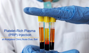 Platelet-rich plasma (PRP) therapy