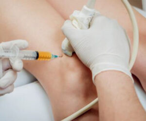 Platelet Rich Plasma Therapy Bali